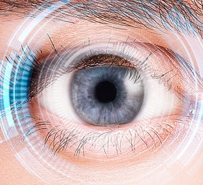 پیوند قرنیه مصنوعی