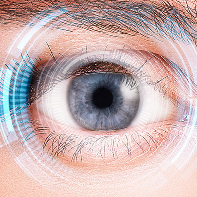 پیوند قرنیه مصنوعی