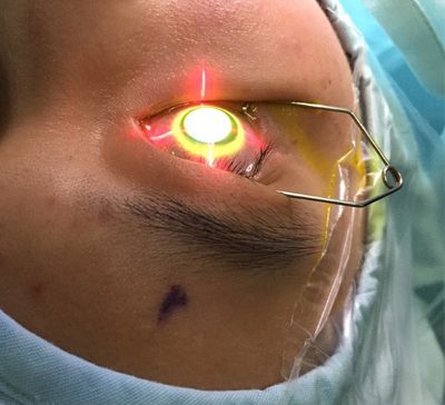 کراس لینکینگ