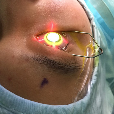 کراس لینکینگ