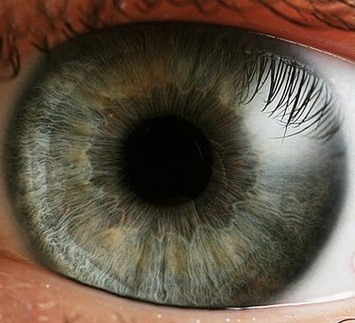 پیوند قرنیه چیست