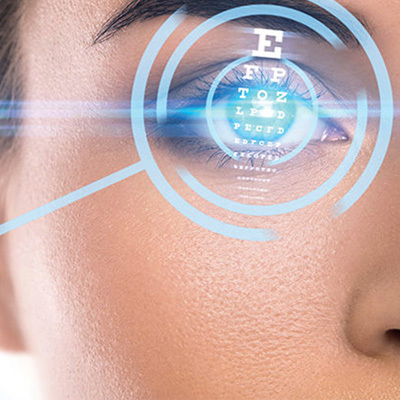 عمل فمتو لیزیک