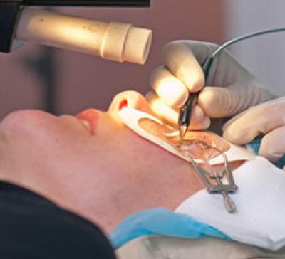 مراقبت‌ های بعد از عمل