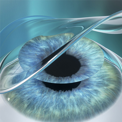 ترنس پی آر کی