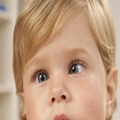 عمل انحراف چشم با لیزر