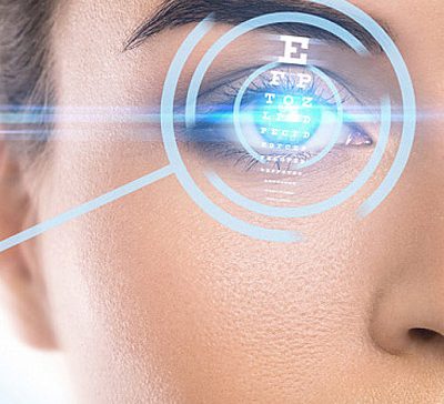 عمل لیزیک چشم آستیگمات