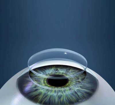 دید چشم بعد از عمل پیوند قرنیه