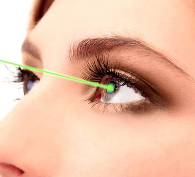 آستیگماتیسم نامنظم