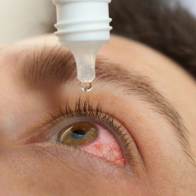 تاری دید بعد از قطره