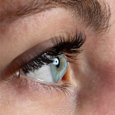 قوز قرنیه و ورزش