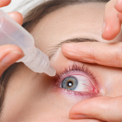 تفاوت خشکی با تحریک چشم